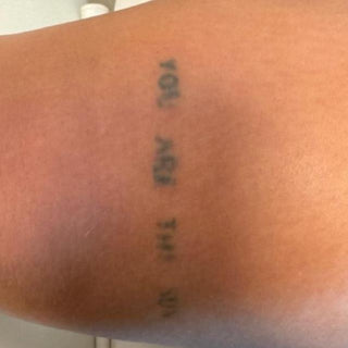 Eksempel på en liten tatovering, og pris for å fjerne den.