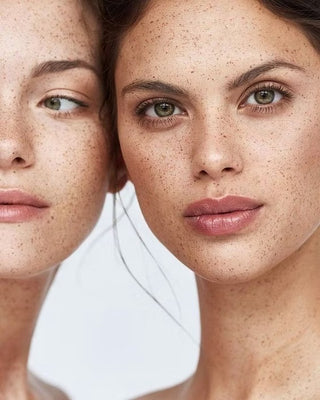 Ameela polynukleotider – injeksjonsbehandling som forbedrer hudens kvalitet, fuktighet og fasthet ved å stimulere cellefornyelse og reparasjon.