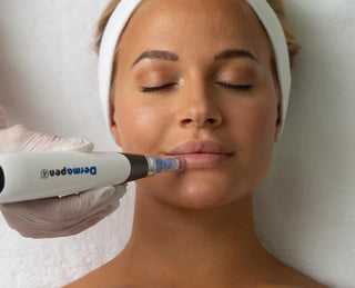 Ansikt under microneedling med Dermapen, en behandling som gir jevnere hudstruktur og reduserer rynker, arr og aldringstegn.
