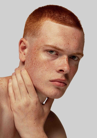 Modell med jevn og strålende hud som illustrerer resultatet av Laser Face-behandling hos Ljoma Hud i Oslo.