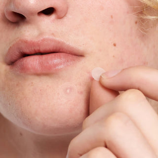 Nærbilde av The INKEY List Hydrocolloid Invisible Pimple Patches som viser plasterets ultratynne og matte design.